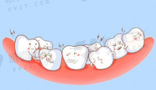 假牙单颗种类区别图解大全,烤瓷牙和全瓷牙区别(图1)